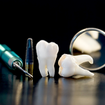 Upgrading Your Smile with Cosmetic Dentistry in Reston