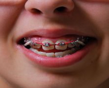 Keep Children Calm with Pediatric Dentistry