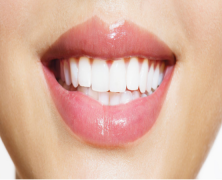 6 Pointers for Choosing a Cosmetic Dentist