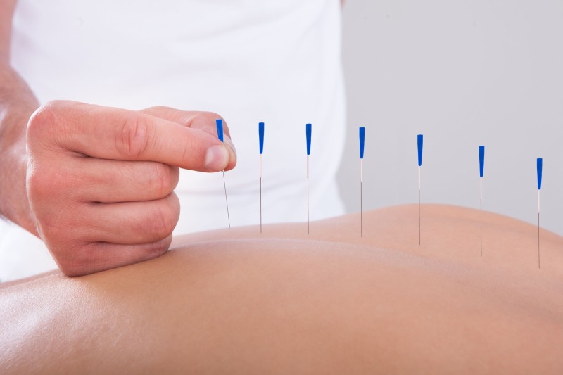 Acupuncture and Herbs: The Ancient Practices Changing Modern Health