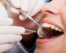 What to Know Before Opting for Partial Dentures in Monroe, LA