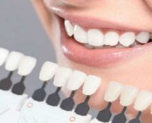 WHAT CAN A COSMETIC DENTIST IN CHICAGO DO FOR YOUR TEETH?