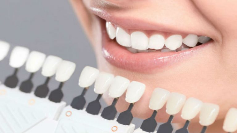 Find Your Best Self with a Cosmetic Dentist in Augusta, GA