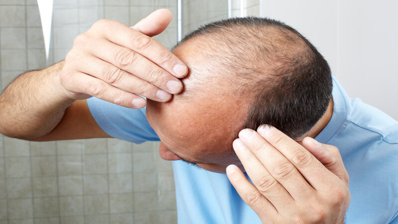 Reclaim Confidence with Hair Restoration Omaha, NE Solutions for Thinning Hair