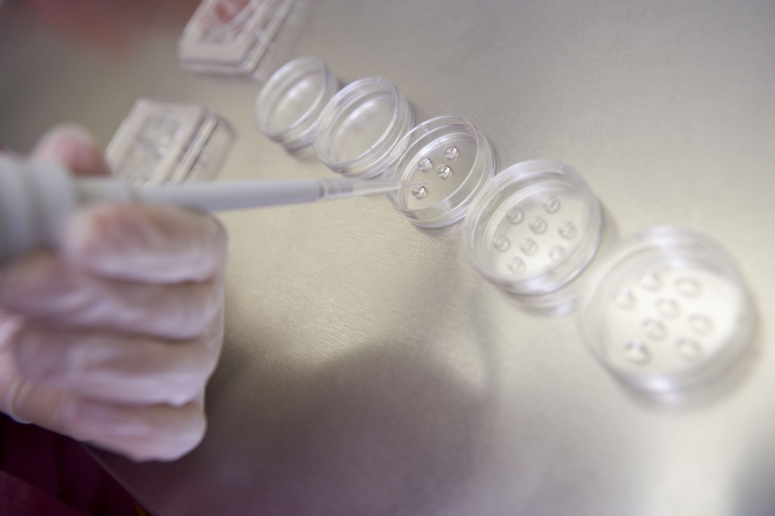 What Is Preimplantation Genetic Testing in Newport Beach, CA?