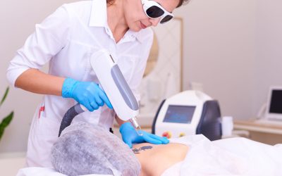 Is It Time for Tattoo Removal in Minneapolis, MN? Here’s How You Know