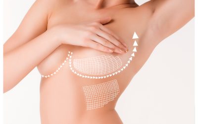 Boost Your Confidence with a Breast Lift in Boston MA