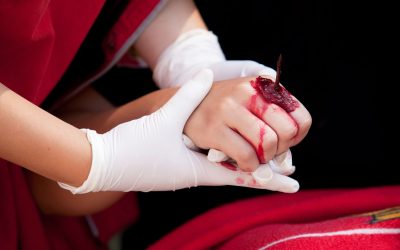 Seeking Justice: Personal Injury Attorney Miami FL’s Role in Your Recovery