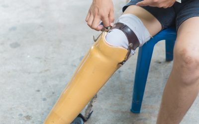Expert Insights on Pediatric Orthotics in Burley ID for Childhood Development